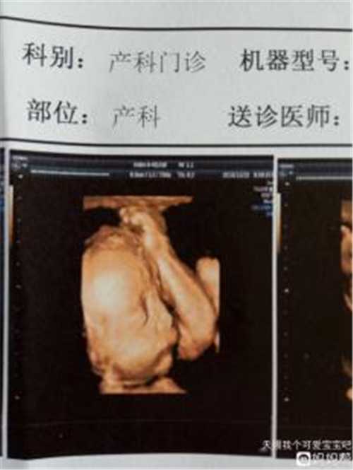 江苏正规公司供卵女孩 江苏省中医院试管婴儿医生比较好的有哪些 ‘怀孕1个多