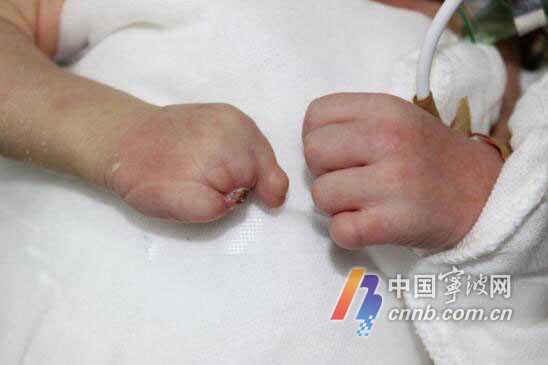忻州供卵代孕指南_忻州代孕的收费_涿州市医院生殖中心做三代试管婴儿成功率