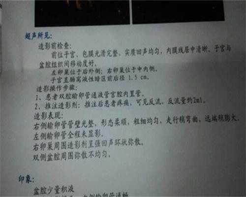 二代试管
