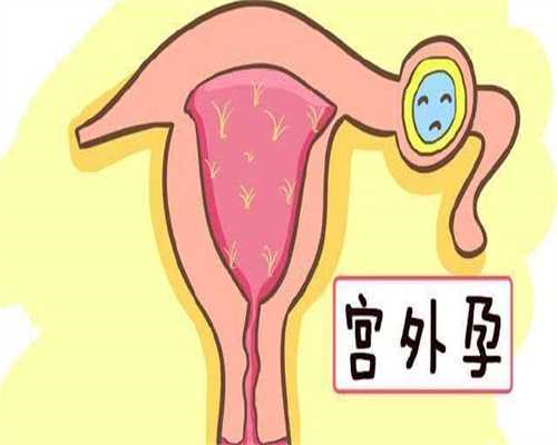 孕前优生检查