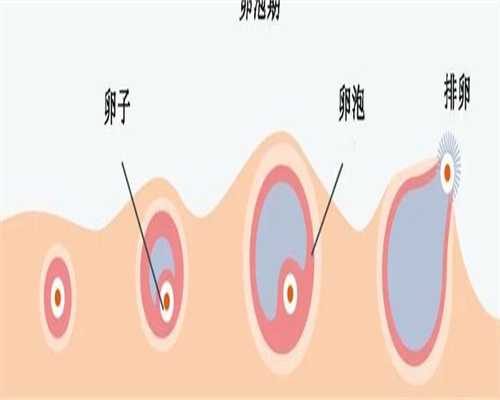 高泌乳素血症不孕
